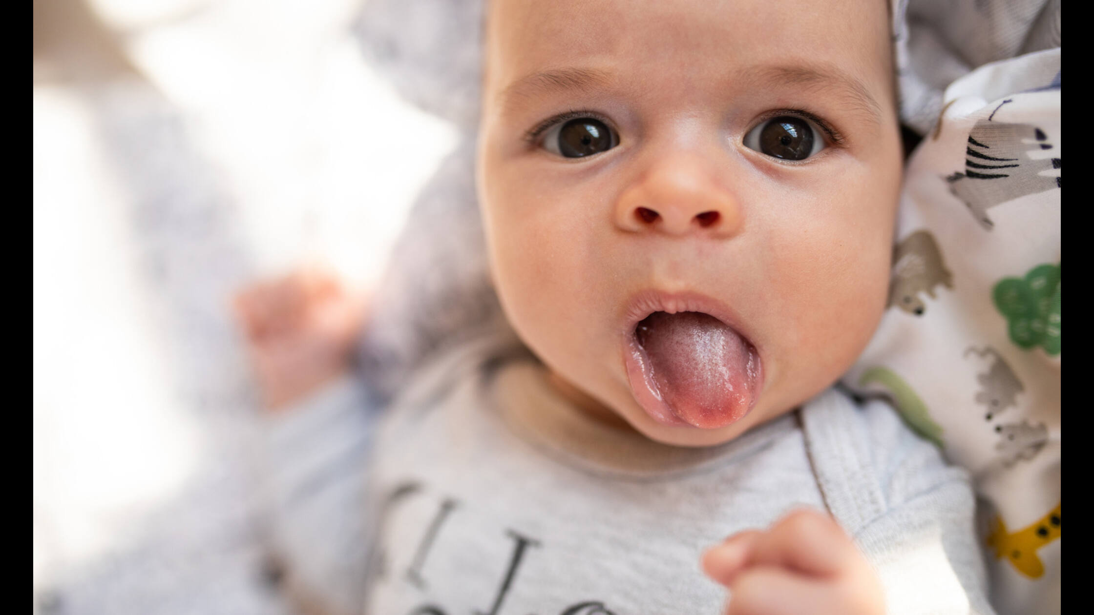 Hình ảnh bé bị cặn sữa
