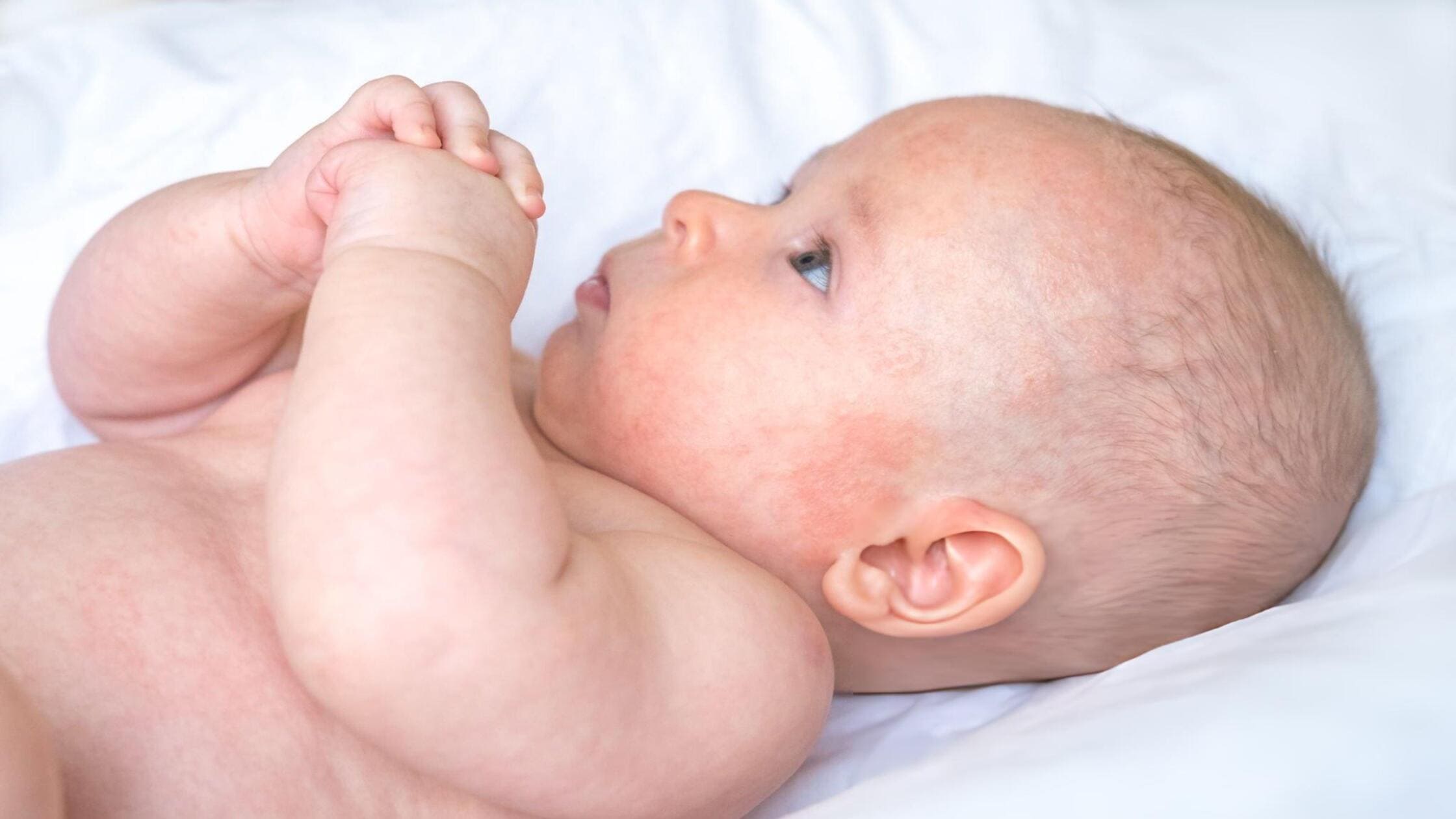 Nên rơ lưỡi cho trẻ sơ sinh bằng gạc tẩm dịch mấy lần một ngày