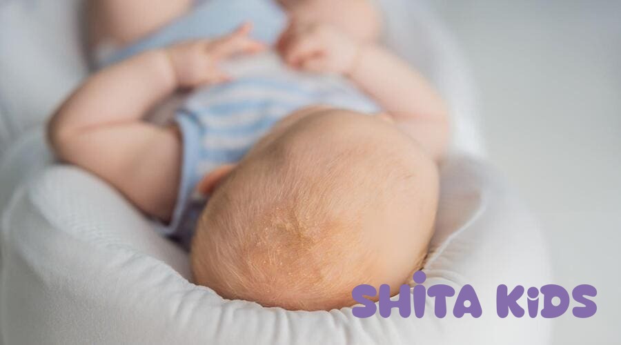 Kỹ thuật mặc tã gập mép để hở cuống rốn giúp rốn bé luôn thông thoáng.