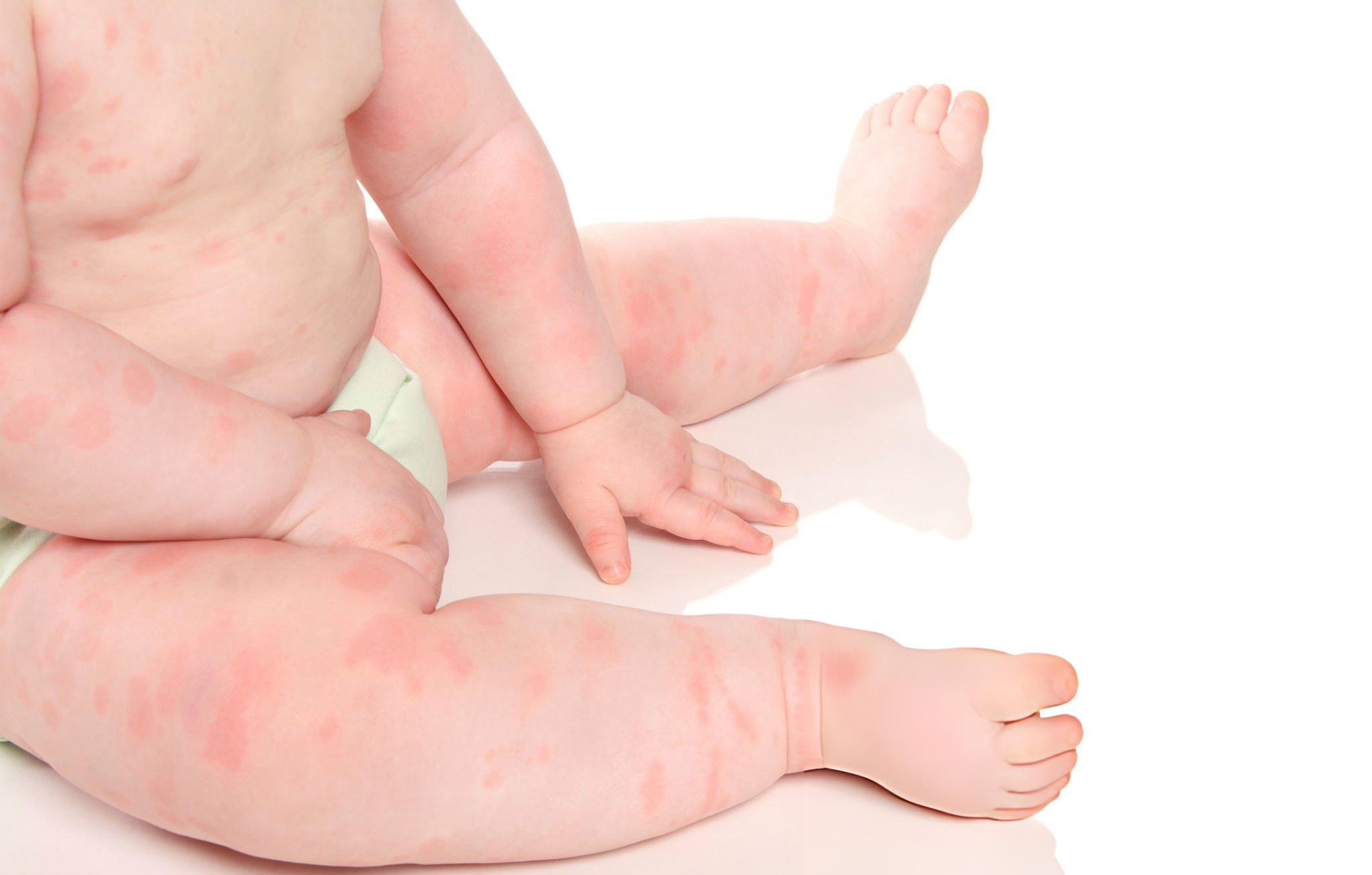 Bé yêu vui vẻ vận động thoải mái khi được chọn đúng loại tã phù hợp.