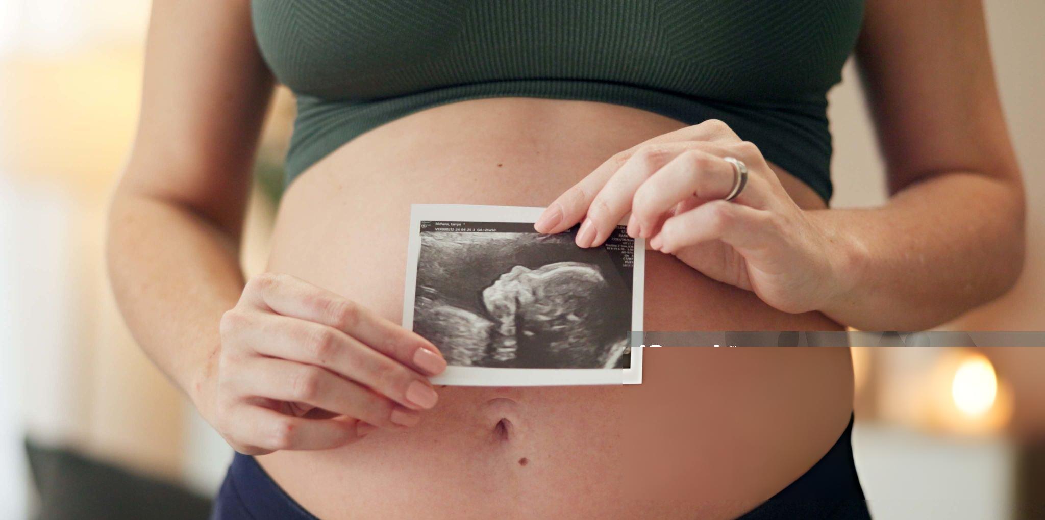 So sánh dứa xanh và dứa chín — mẹ bầu chỉ nên ăn dứa chín vàng.