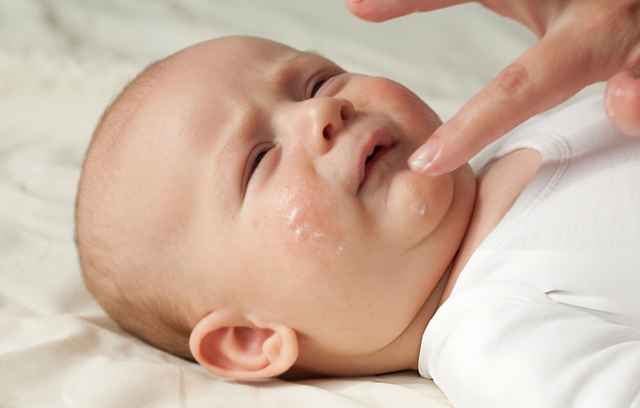 Cách massage nướu cho bé bằng gạc rơ lưỡi để giảm biếng bú.