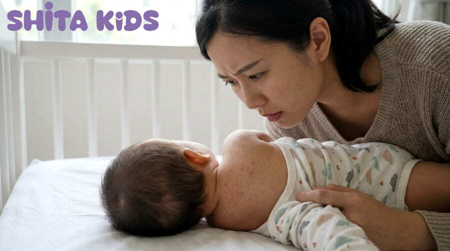 cách trị rôm sảy cho bé tại nhà mùa hè khi bé nổi mẩn đỏ li ti vùng cổ lưng