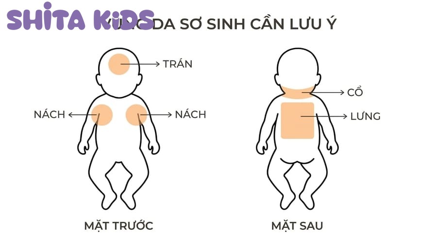 các vùng da bé hay nổi mẩn ngứa khi ra nhiều mồ hôi mùa hè